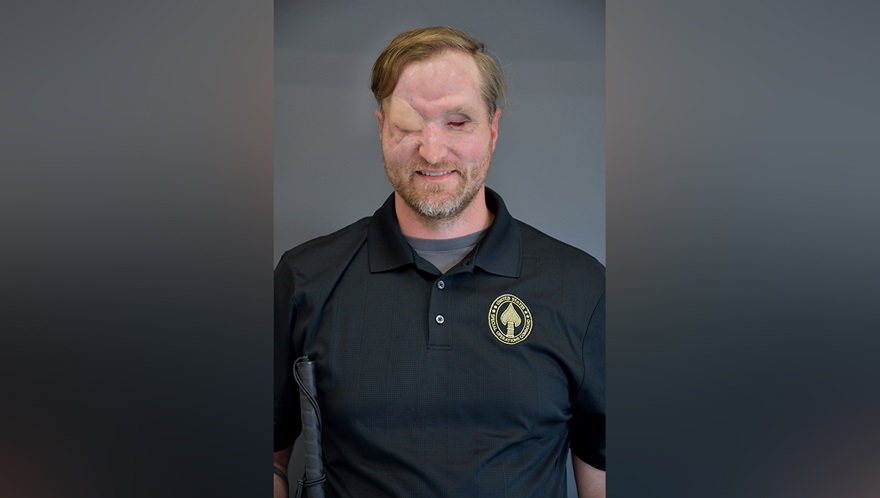 From ‘zero percent chance’ of survival to the 2026 Warrior Games: Maj. Jonathan Turnbull’s inspiring story