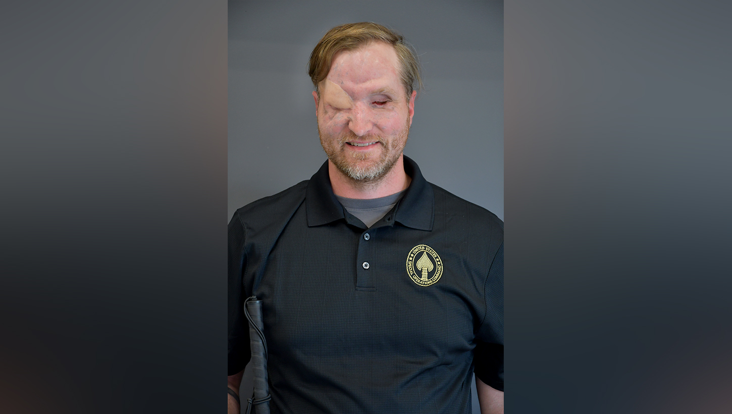 Image of From ‘zero percent chance’ of survival to the 2026 Warrior Games: Maj. Jonathan Turnbull’s inspiring story.