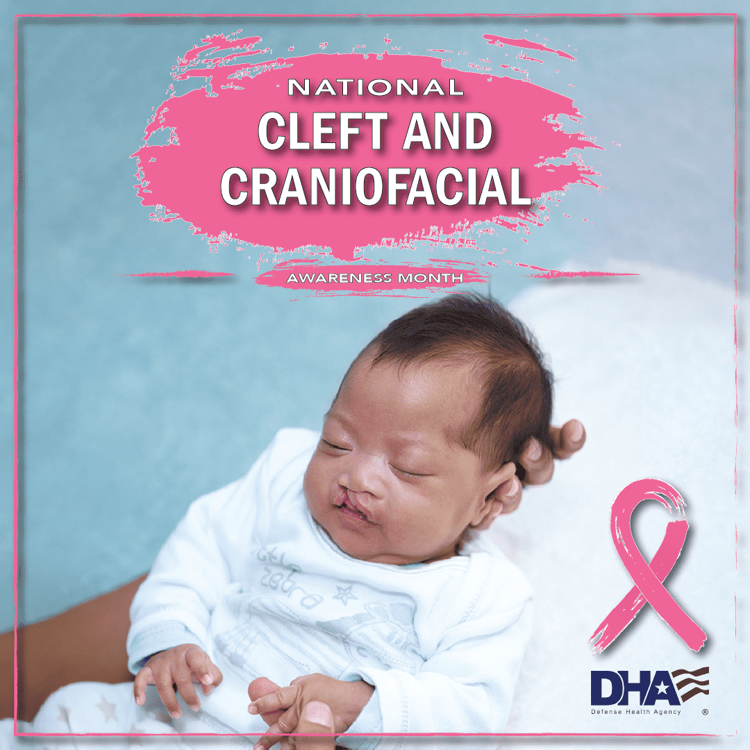 Link to Infographic: National Cleft and Craniofacial Awareness Month