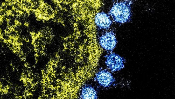 The novel coronavirus is a variant of other coronaviruses, such as this colorized transmission electron micrograph of Middle East respiratory syndrome (MERS) virus particles (blue) found near the periphery of an infected VERO E6 cell (yellow). Image captured and color-enhanced at the NIAID Integrated Research Facility in Fort Detrick, Maryland. (Photo by NIAID)