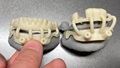 3D-printed teeth