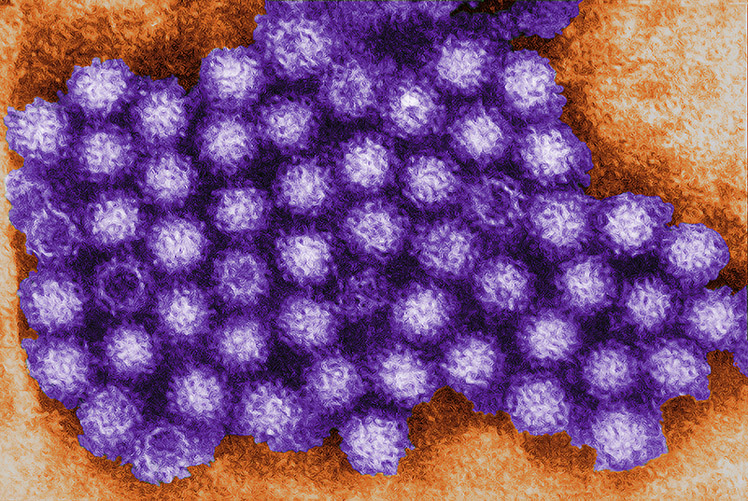 Image of Norovirus are a group of related, single-stranded RNA, nonenveloped viruses that cause acute gastroenteritis in humans. (Photo Courtesy: CDC/Charles D. Humphrey. Click to open a larger version of the image.
