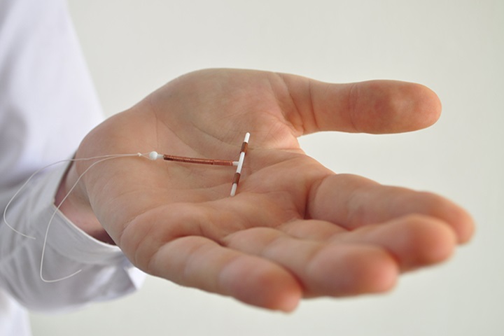 Image of A copper intrauterine device.