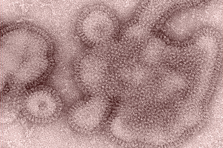 Captured in 2011, this transmission electron microscopic (TEM) image depicts some of the ultrastructural details displayed by H3N2 influenza virions, responsible for causing illness in Indiana and Pennsylvania in 2011. See PHIL 13469, for the diagrammatic representation of how this Swine Flu stain came to be, through the “reassortment” of two different Influenza viruses.  Credit: CDC/ Dr. Michael Shaw; Doug Jordan, M.A.
