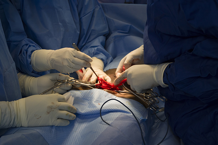 Image of Medical care professionals repair a hernia. Click to open a larger version of the image.