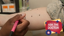 Allergy Test