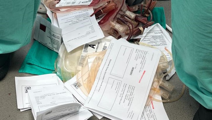 Damage Control Resuscitation in fellow involved case. 