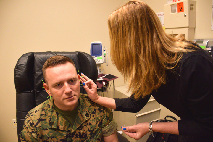 Marine Staff Sgt. Andrew Gales participates in ‘battlefield’ acupuncture, also known as ‘ear acupuncture,’ at Walter Reed National Military Medical Center, as a treatment for anxiety related to PTSD. (U.S. Navy photo courtesy Mass Communication Specialist 2nd Class Kevin Cunningham)