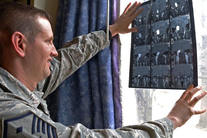 Air Force Master Sgt. Geoffrey VanDyck, the 707th Force Support Squadron’s first sergeant, views an image of the tumor found on his auditory nerve, at Fort Meade, Maryland. In May 2005, VanDyck was diagnosed with acoustic neuroma, a noncancerous, normally slow growing tumor that develops on the main vestibular nerve that leads from the inner ear to the brain. (U.S. Air Force photo by Tech. Sgt. Veronica Pierce)