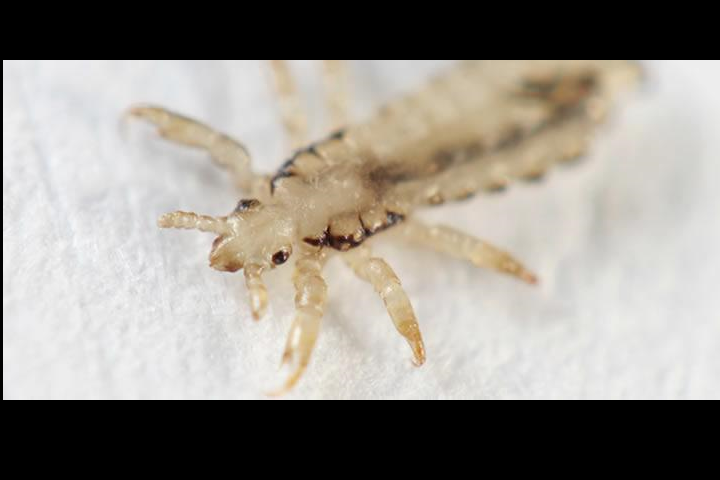 Lice are parasitic insects that can be found on people’s heads, and bodies. Human lice survive by feeding on human blood. (EPA photo)
