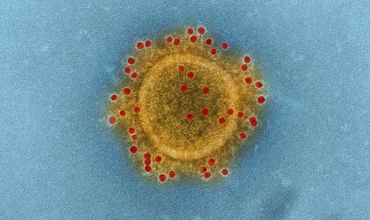 This image shows Middle East respiratory syndrome coronavirus particle envelope proteins immunolabeled with rabbit HCoV-EMC/2012 primary antibody and goat anti-rabbit 10-nanometer gold particles. (National Institute of Allergy and Infectious Disease photo)
