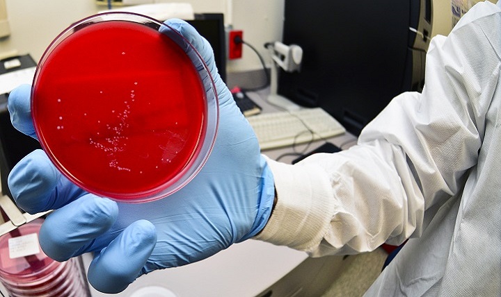An Air Force laboratory technician holds up a blood culture sample that was placed in a controlled environment in the laboratory.