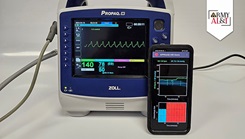 The U.S. Army Medical Research and Development Command’s Biotechnology High Performance Computing Software Applications Institute developed an Android app that collects heart rate and blood pressure data. 