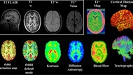 MRI brain scans
