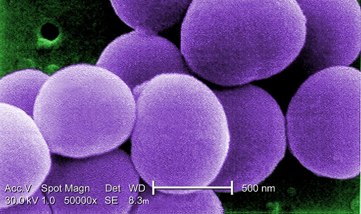 This strain of antibiotic-resistant Staphylococcus aureus bacteria is magnified 50,000 times.