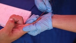 finger_prick_CPG_article